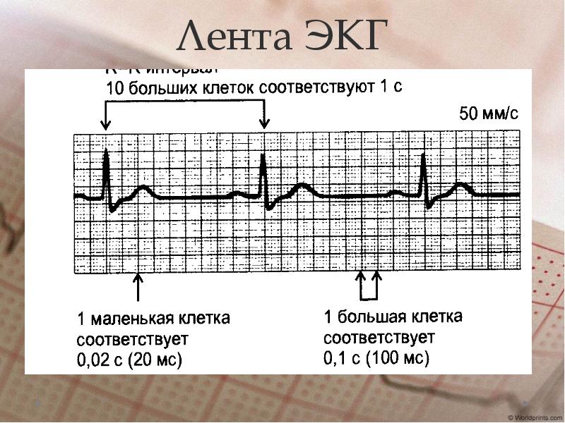 Задание экг. Методика ЭКГ. Здоровое ЭКГ.