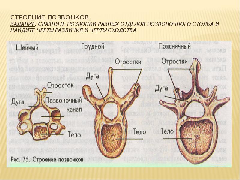 Позвонки различных отделов позвоночного столба
