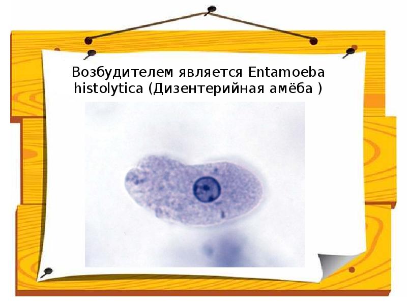 Амебиаз презентация казакша