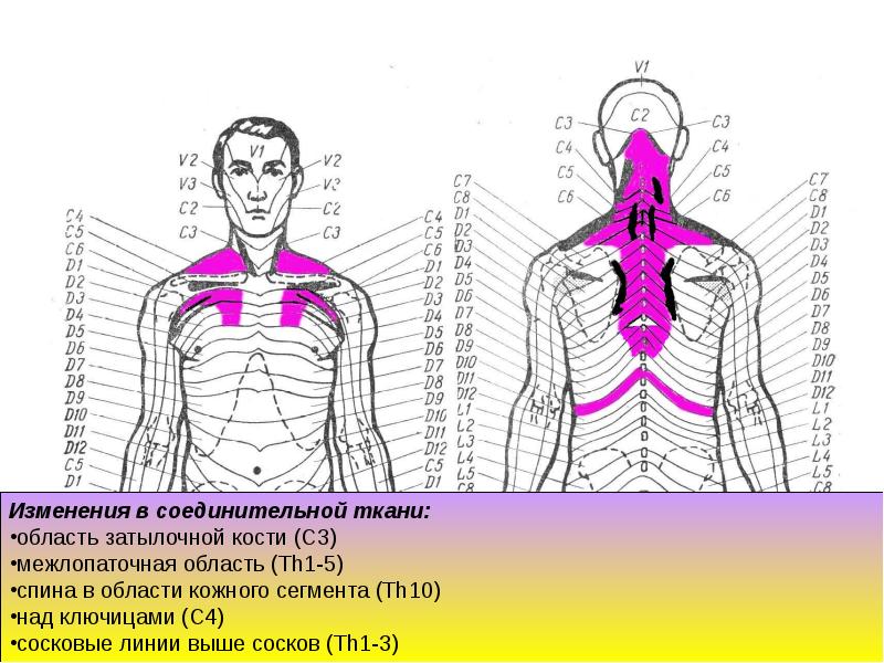 Рефлекторно сегментарный массаж схема