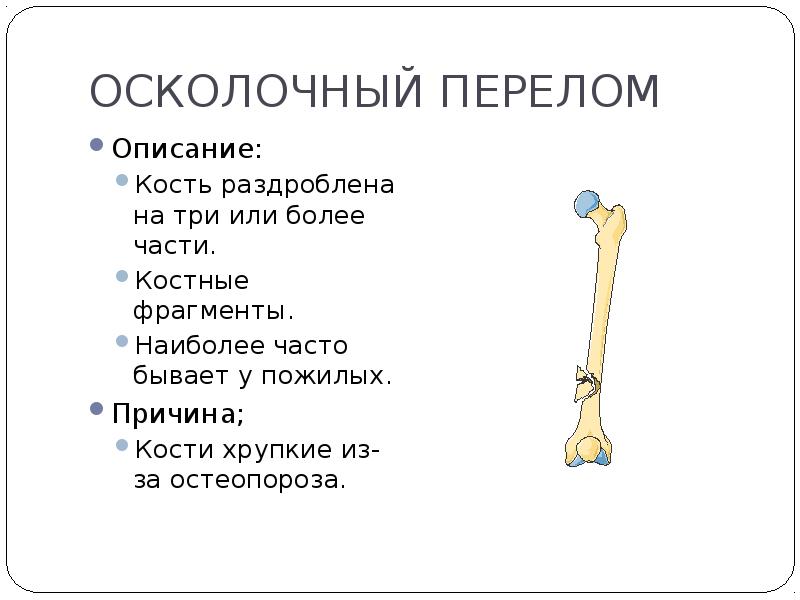 Самые хрупкие кости