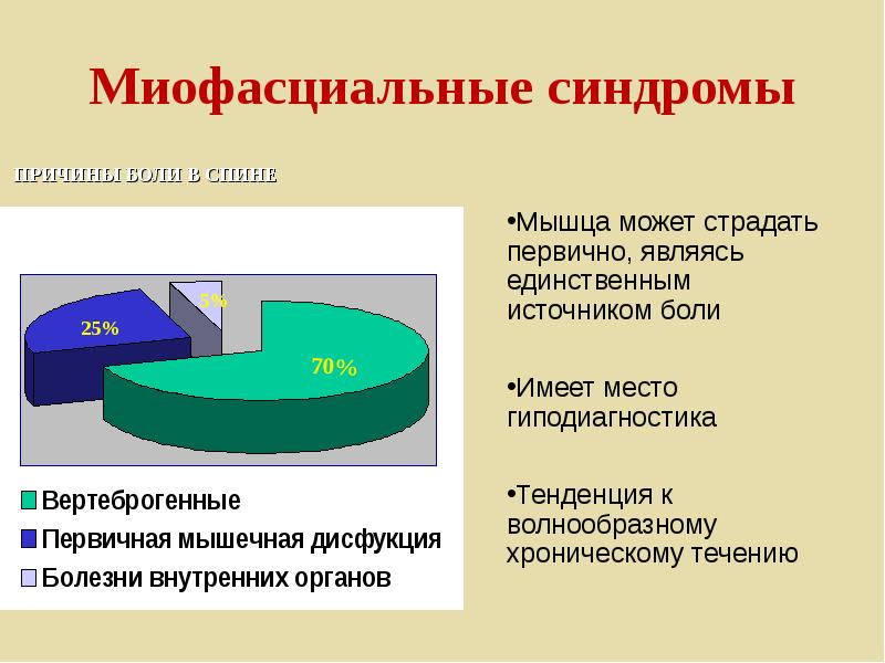 Миофасциальный синдром