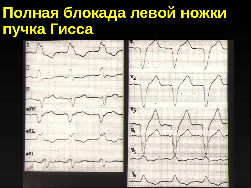 Полная блокада