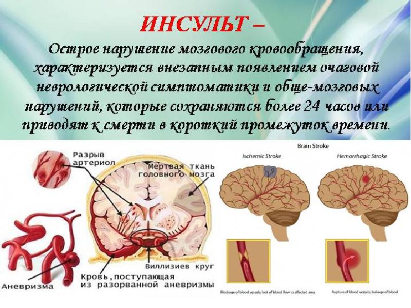 Проект про инсульт