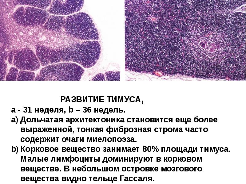 Тельца гассаля гистология