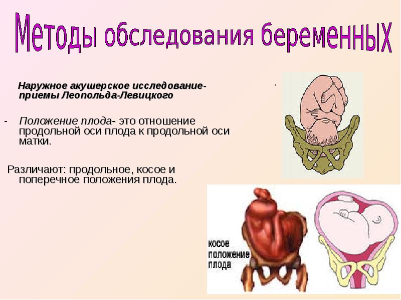 Акушерская терминология презентация