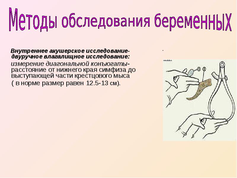 Внутреннее исследование. Внутренние исследования в акушерстве. Влагалищное акушерское исследование. Внутреннее акушерское исследование. Внутреннее (влагалищное) акушерское исследование.