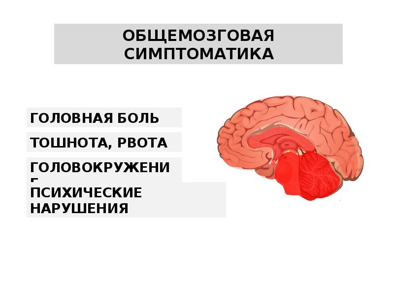 Опухоль головного мозга симптомы на ранних стадиях