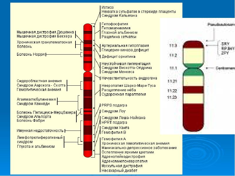 Синдром альпорта презентация