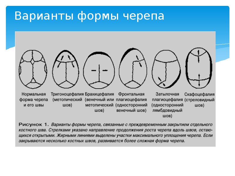 Варианты формы черепа