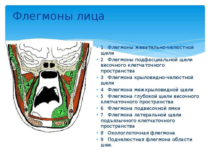 Флегмоны лица  1	Флегмоны жевательно-челюстной щели 2	Флегмоны подфасциальной щели височного клетчаточного