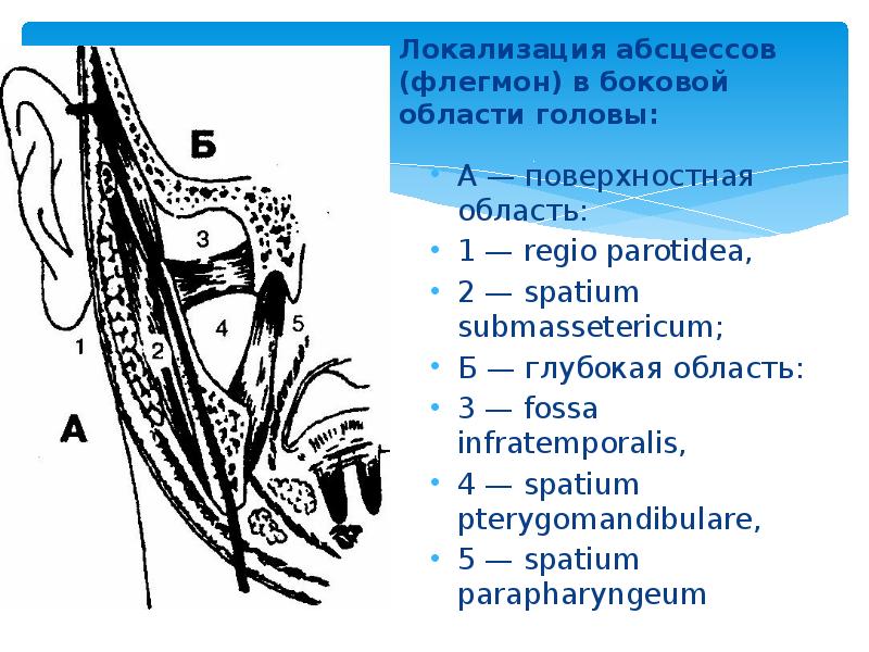 Локализация абсцессов (флегмон) в боковой области головы:  А — поверхностная