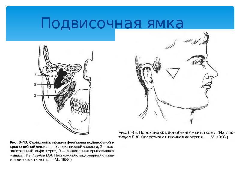 Подвисочная ямка