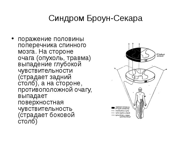 Синдром броун секара это. Синдром половинного поражения спинного мозга (синдром Броун-Секара).. Синдром Броун Секара схема. Выпадение глубокой чувствительности очаг поражения. Уровень поражения Броун Секара.