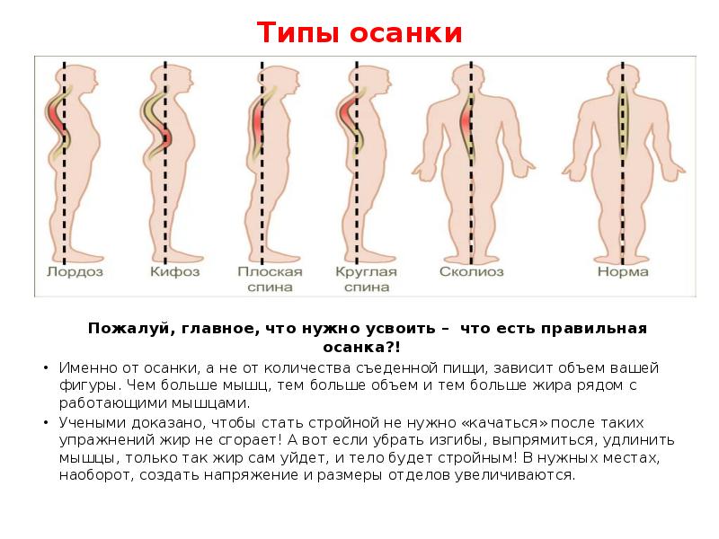 Типы осанки. Типы осанки человека. Типы осанки по штаффелю. Нормальный Тип осанки. Характеристика типов осанки.