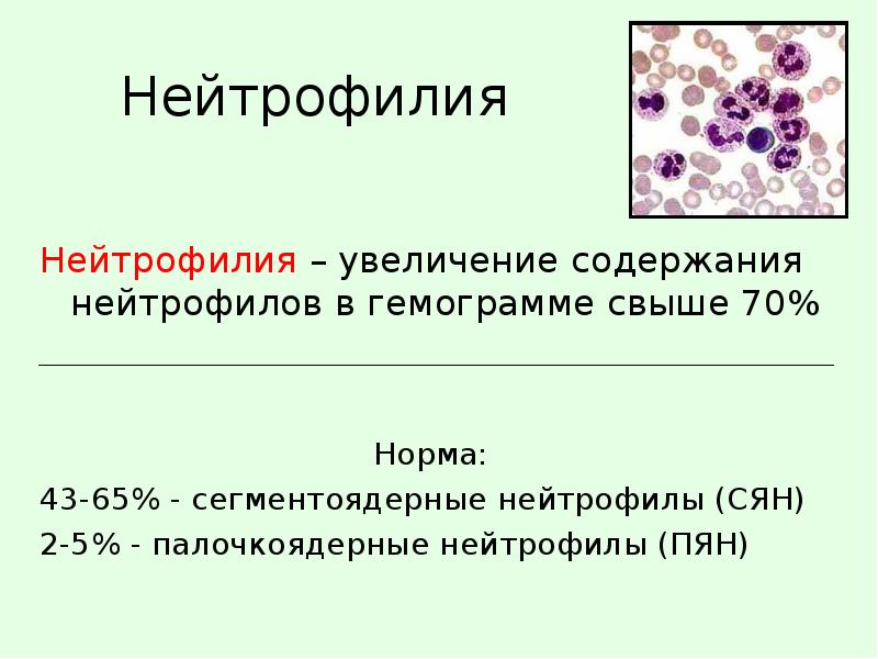 Повышение нейтрофилов. Нейтрофилия. Рост сегментоядерных нейтрофилов. Увеличение сегментоядерных нейтрофилов. Повышение содержания нейтрофилов это.