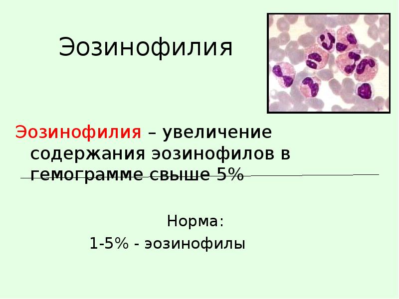 Повышенное содержание эозинофилов в крови