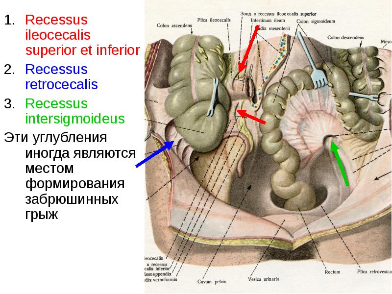 Треугольник кало топографическая анатомия. Межсигмовидное углубление брюшины. Синусы брюшной полости топографическая анатомия. Слепокишечные складки брюшины. Каналы Нижнего этажа брюшной полости.