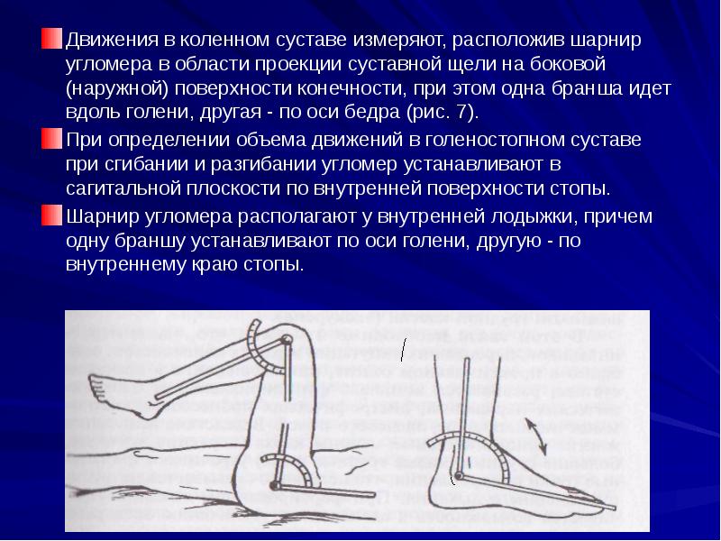 Повреждения коленного сустава травматология презентация