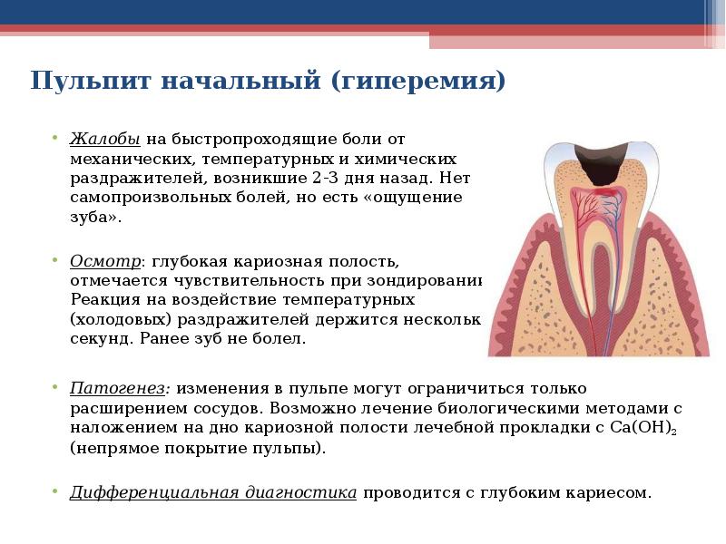 Лечение пульпита Томск Доброты Лечение зубов под наркозом Томск Каменская