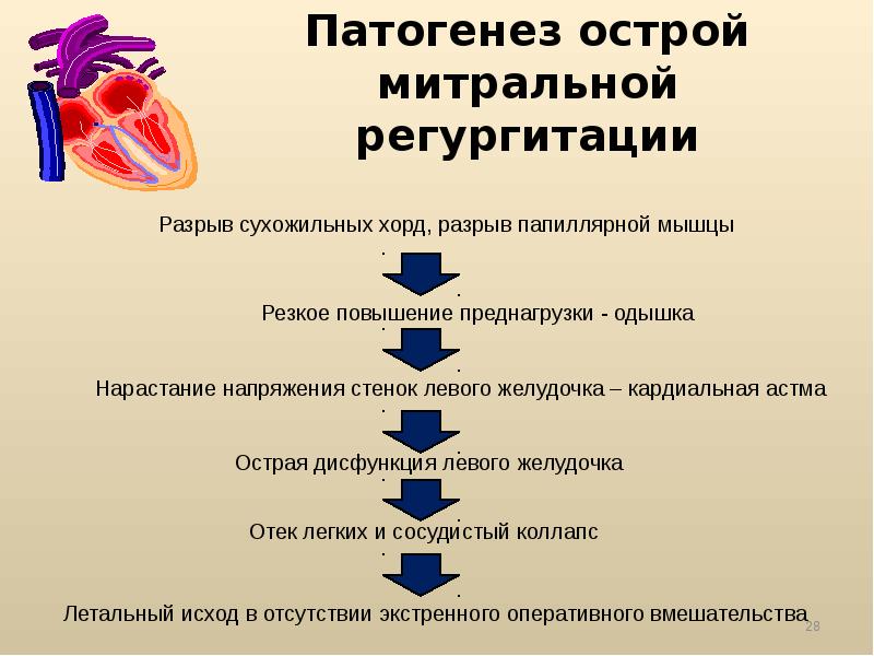 Сердечная недостаточность митрального клапана. Приобретенные пороки аортального клапана патогенез. Механизм развития клапанных пороков сердца. Пороки сердца этиология. Митральная недостаточность патогенез.