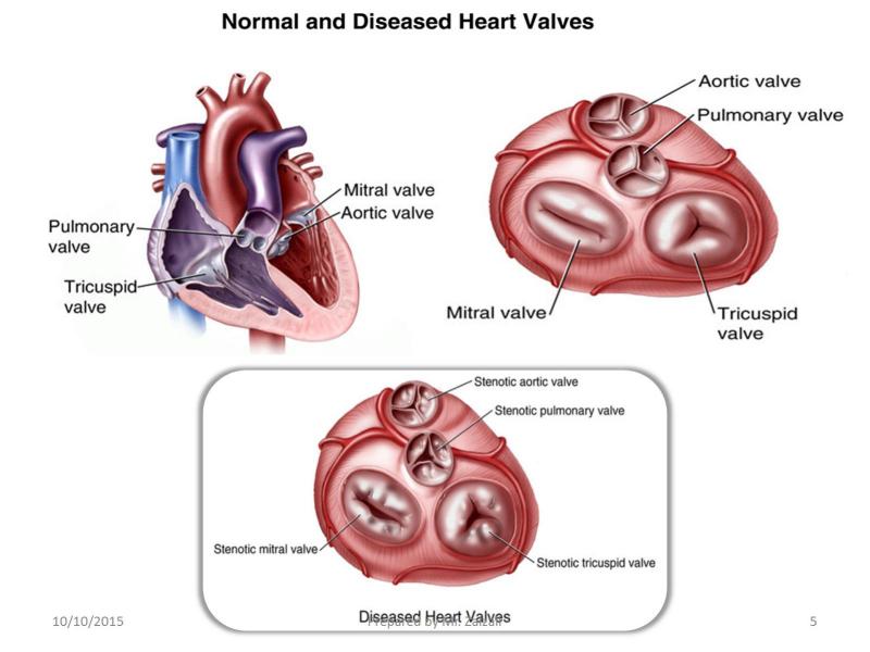 Section two. Tricuspid Valve and Pulmonary Valve.