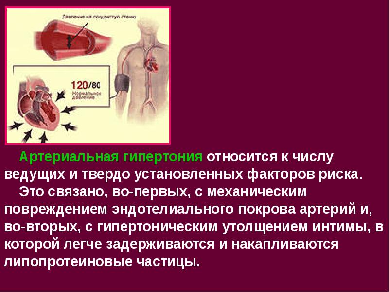 презентация на тему артериальная гипертензия. систолическое артериальное давление норма. тест артериальной гипертонии. тест по артериальной гипертензии. тест по артериальной гипертензии.