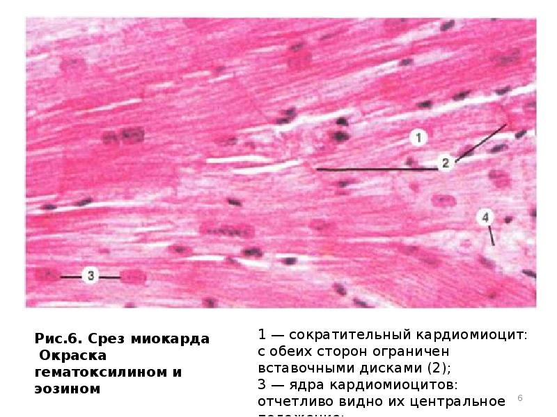 Миокард на рисунке