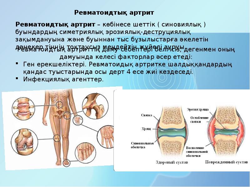 Балшықпен емдеу презентация