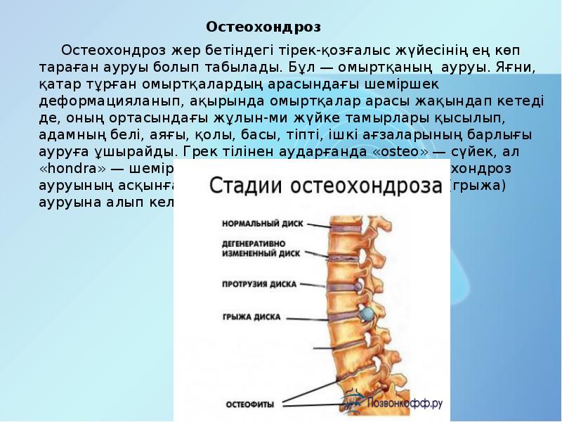 Презентация про остеохондроз