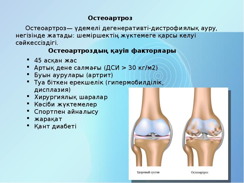 Презентация на тему остеоартроз