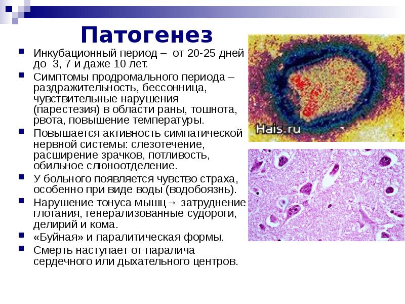 Вирус бешенства презентация по микробиологии