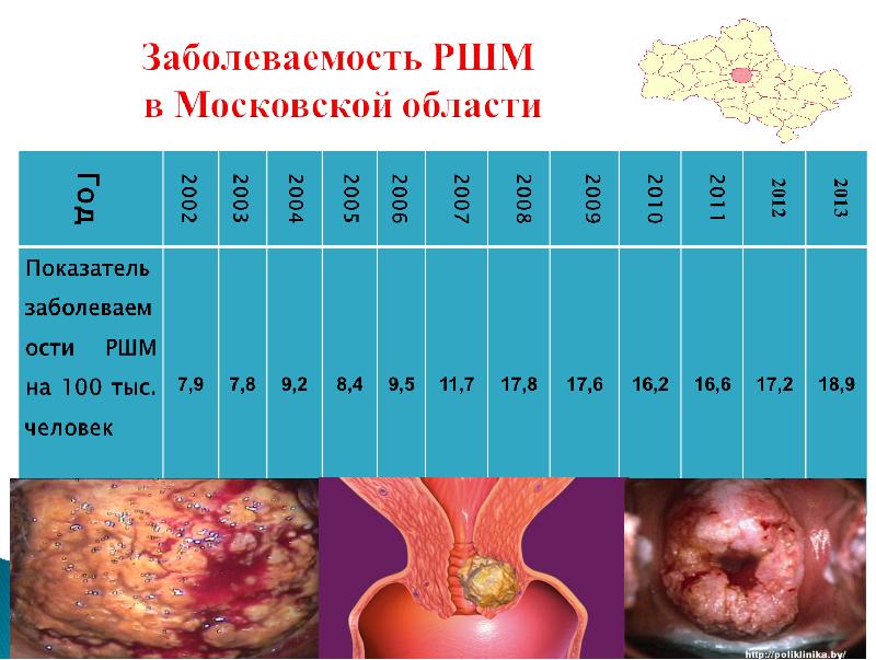 Профилактика рака шейки матки презентация