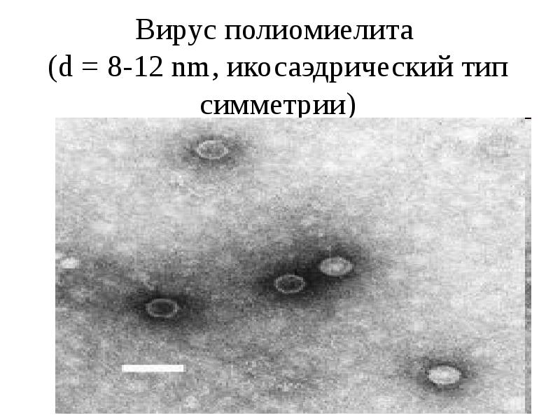 Вирус полиомиелита  (d = 8-12 nm, икосаэдрический тип симметрии)