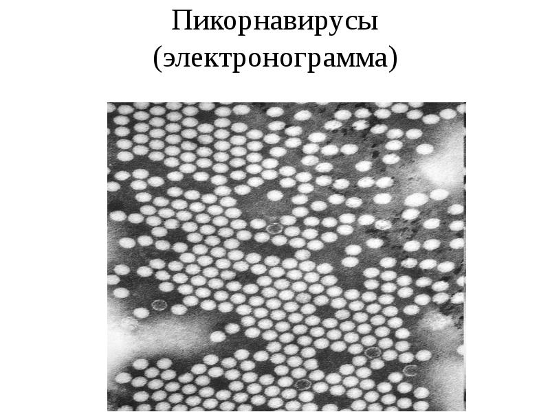 Пикорнавирусы (электронограмма)