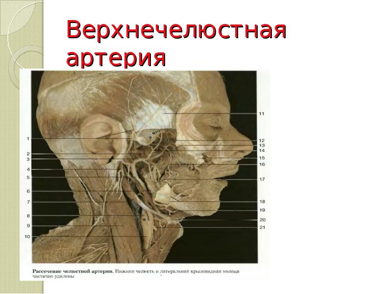 Верхнечелюстная артерия