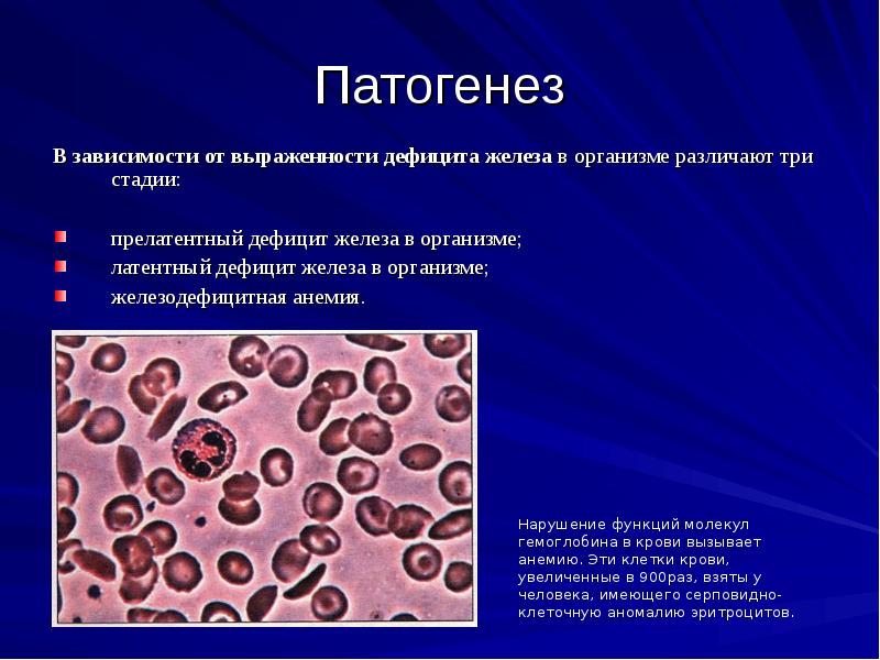 Железодефицитная анемия патофизиология презентация