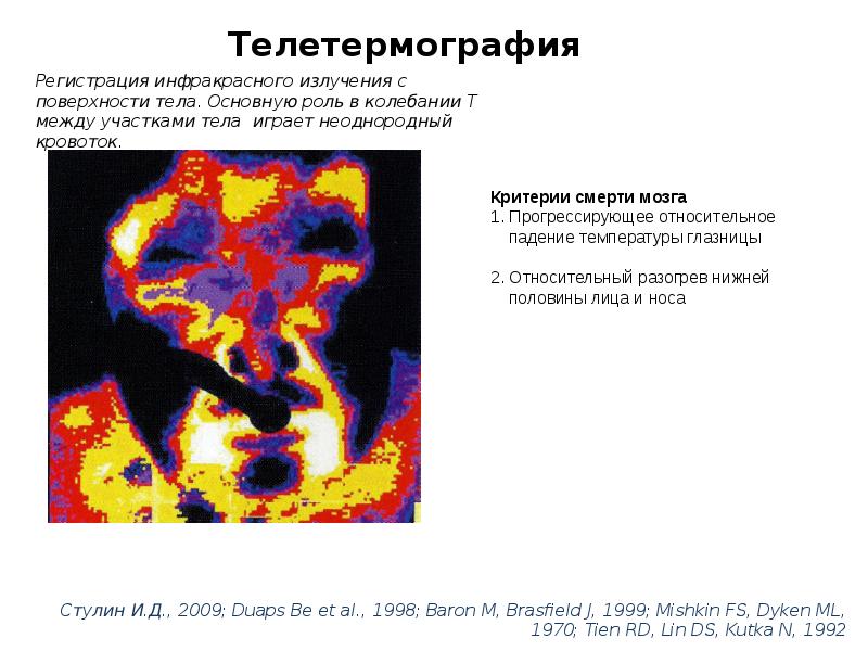 Смерть мозга презентация