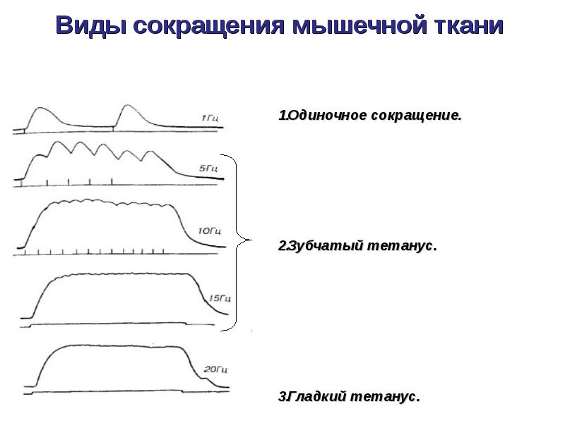 Типы сокращений. Гладкий и зубчатый тетанус физиология. Тетанус физиология мышц. Гладкий тетанус это физиология. Тетаническое мышечное сокращение (тетанус).