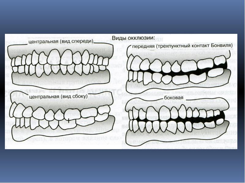 Положение центральной окклюзии