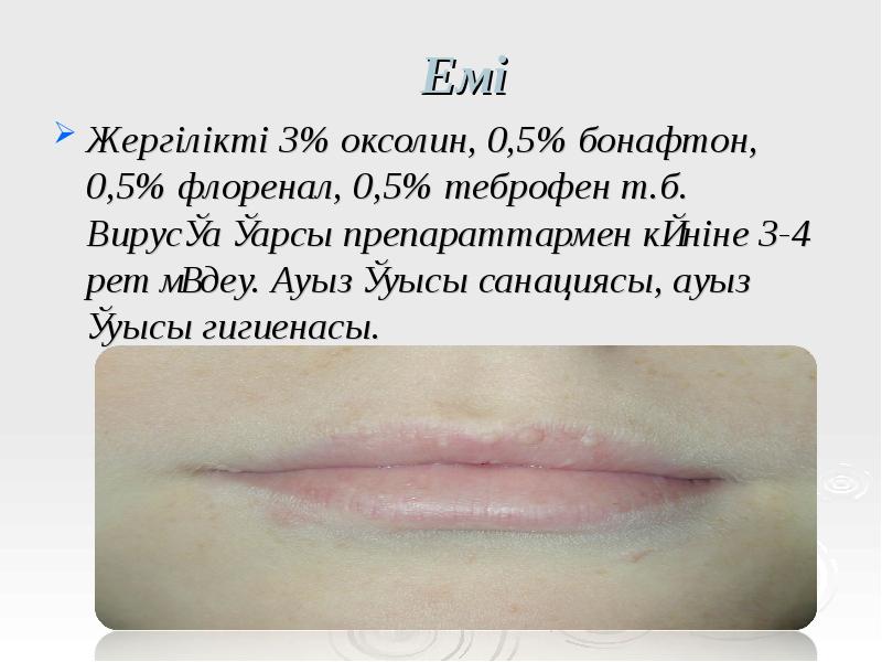 Емі
Жергілікті 3% оксолин, 0,5% бонафтон, 0,5% флоренал, 0,5% теброфен т.б. Емі
Жергілікті 3% оксолин, 0,5% бонафтон, 0,5% флоренал, 0,5% теброфен т.б.