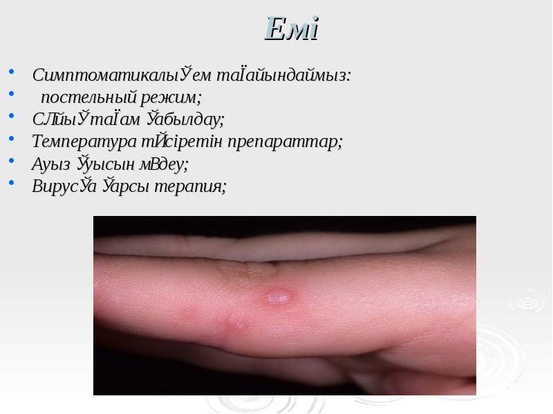 Емі
Симптоматикалық ем тағайындаймыз:
постельный режим;
Сұйық тағам қабылдау;
Температура Емі
Симптоматикалық ем тағайындаймыз:
постельный режим;
Сұйық тағам қабылдау;
Температура