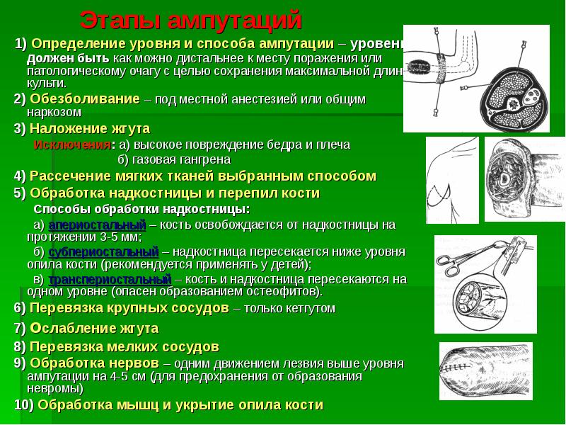 Реферат: Ампутации и экзартикуляции