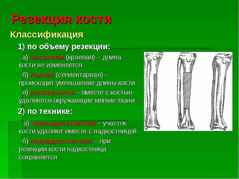 Реферат: Ампутации и экзартикуляции