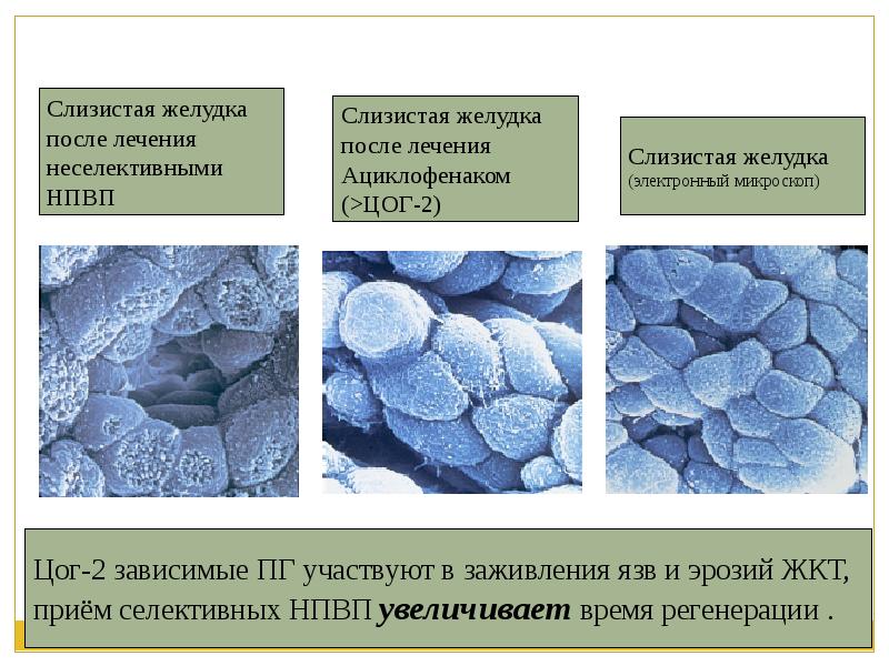 Восстановление слизистой. Восстановление слизистой желудка. Регенерация слизистой желудка. Лекарства для заживления слизистой желудка. Препарат восстанавливающий слизистую желудка.