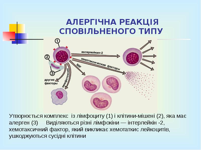 АЛЕРГІЧНА РЕАКЦІЯ СПОВІЛЬНЕНОГО ТИПУ АЛЕРГІЧНА РЕАКЦІЯ СПОВІЛЬНЕНОГО ТИПУ