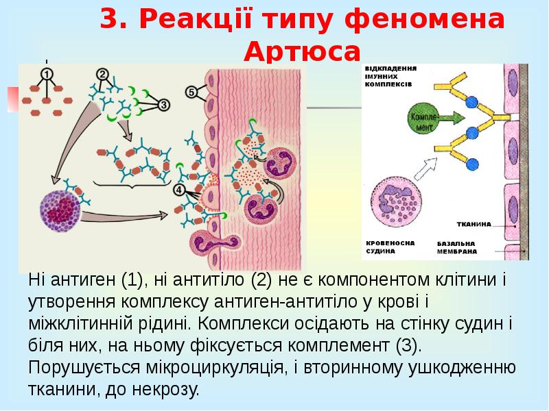 3. Реакції типу феномена Артюса 3. Реакції типу феномена Артюса