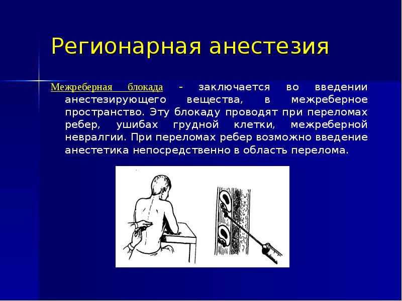 Регионарная анестезия презентация