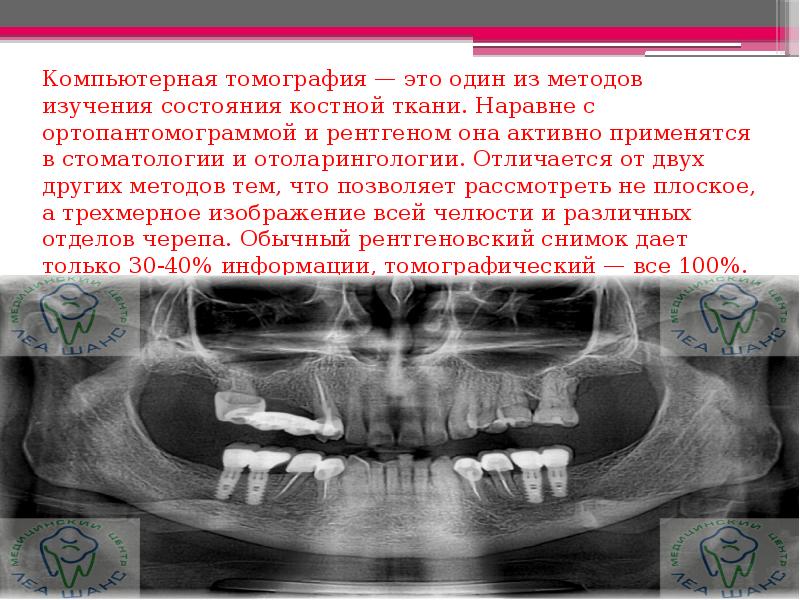 Мрт в стоматологии презентация