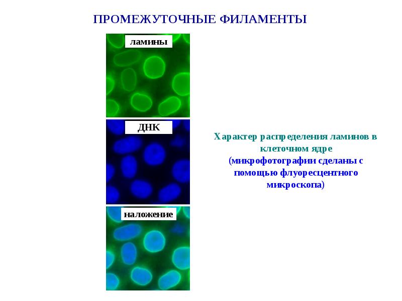 Клетка асу. Цитоскелет это опорно двигательная система. Промежуточные филаменты. Промежуточные филаменты в клетке. Виментиновые промежуточные филаменты.